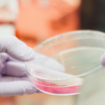 petri dish
